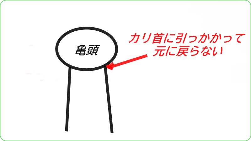 カントン包茎になってしまう理由を説明するイラスト